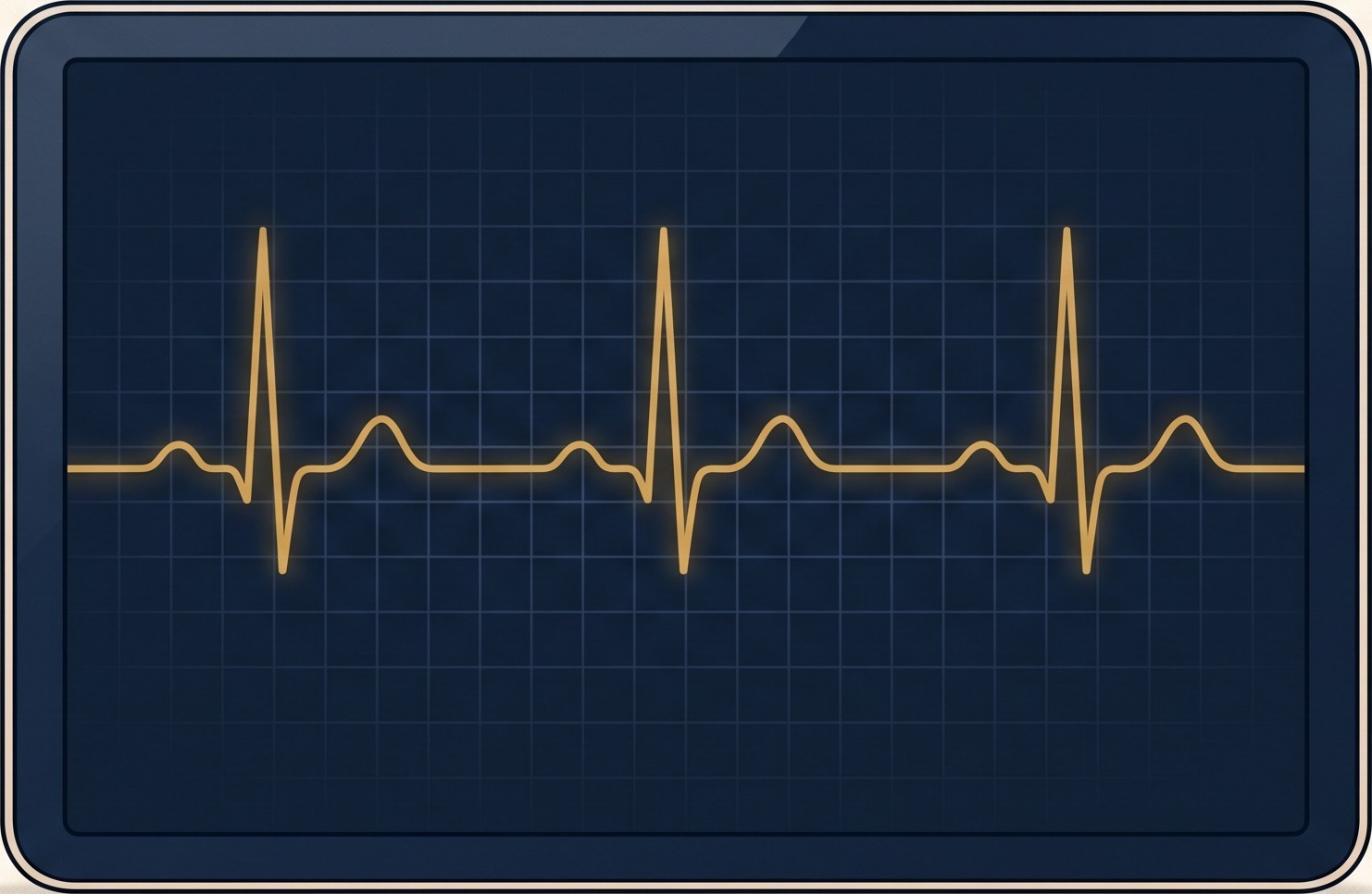 A single continuous ECG heartbeat trace on a monitor, the body read as one connected signal