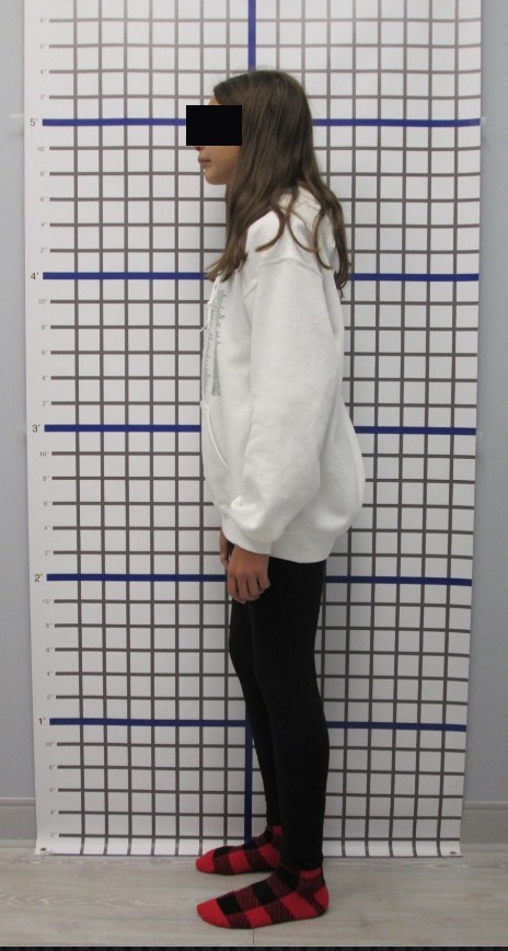 Full-body posture read against a plumb-line grid wall, before, eyes blocked for privacy